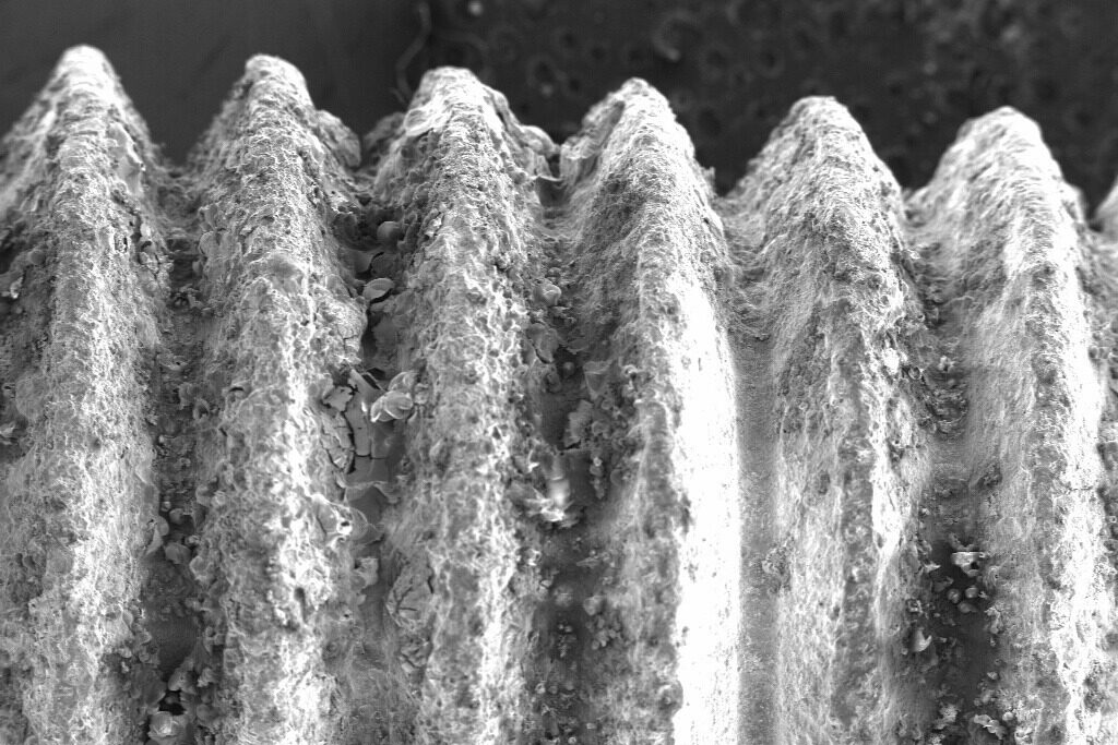 Imagem de microscopia eletrônica de varredura
